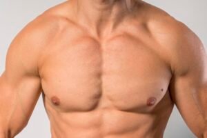 Male chest after gynecomastia surgery by Best Cosmetic Surgeon in Bhopal Dr. Prashant Nema