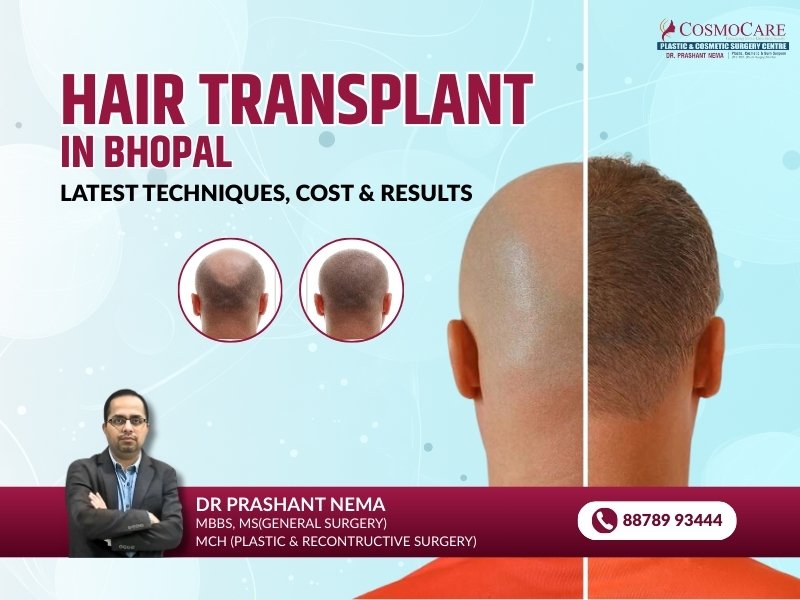 Best Hair Transplant in Bhopal: Latest Techniques, Cost & Results