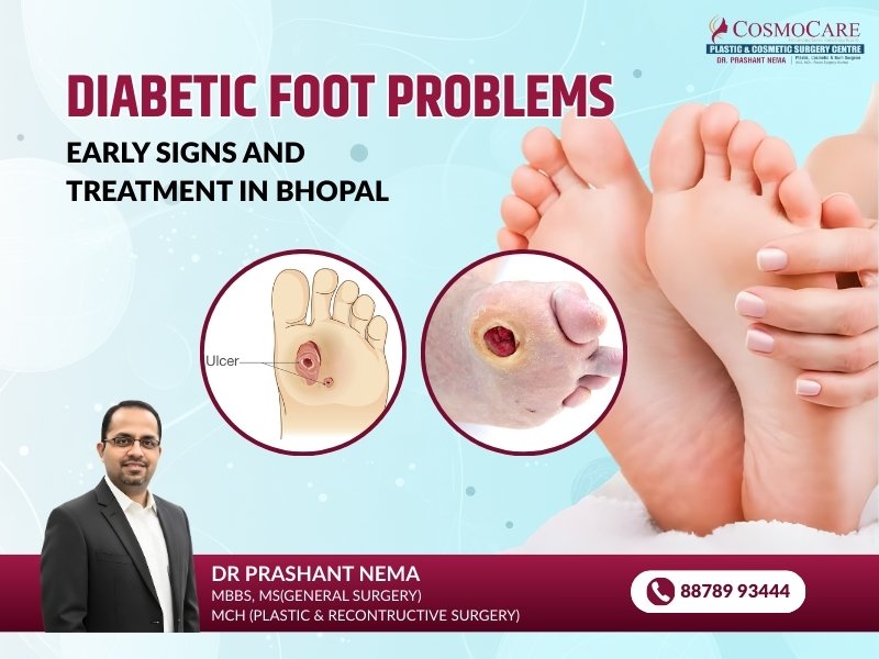 Diabetic Foot Treatment in Bhopal: Causes, Symptoms & Care