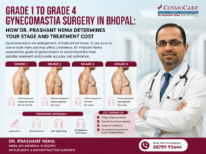 Grade 1 to Grade 4 Gynecomastia Surgery in Bhopal: How Dr. Prashant Nema Determines Your Stage and Treatment Cost
